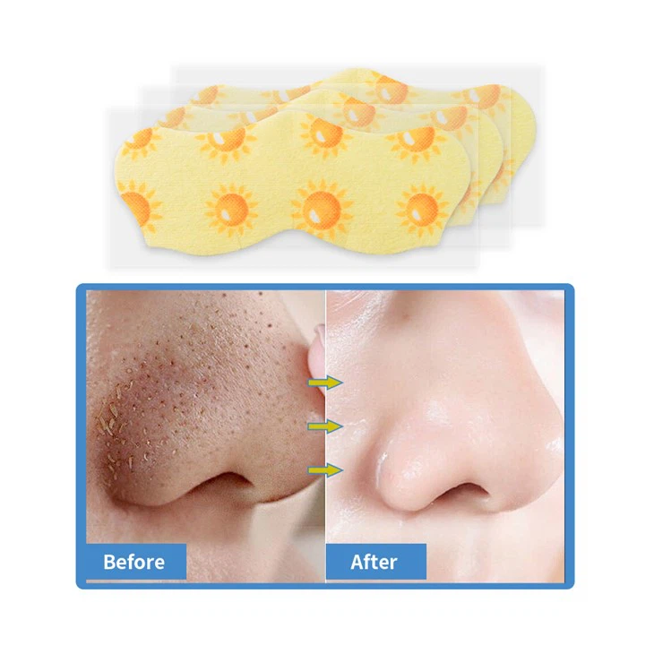 nose strips (15)